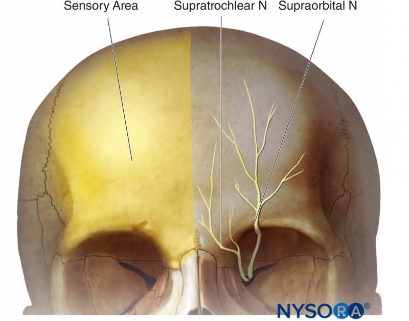 Blokada nerwu trójdzielnego gałąź oczna nerwy nadoczodołowy i nadbloczkowy